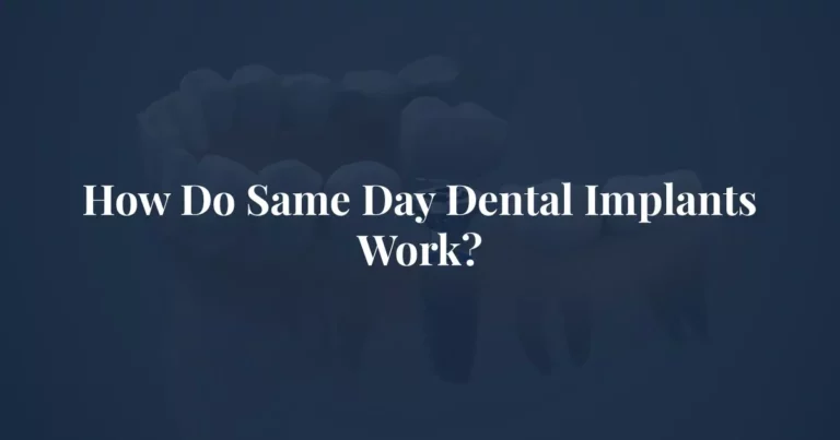 How Do Same Day Dental Implants Work? at Center for Oral & Maxillofacial Surgery