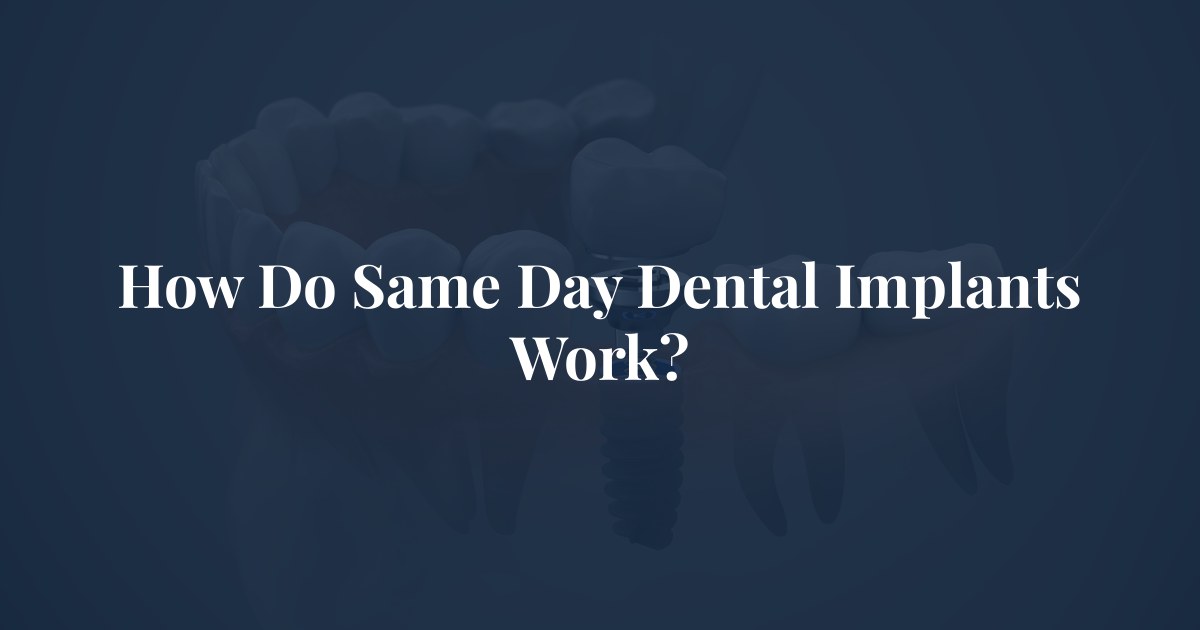 How Do Same Day Dental Implants Work? at Center for Oral & Maxillofacial Surgery